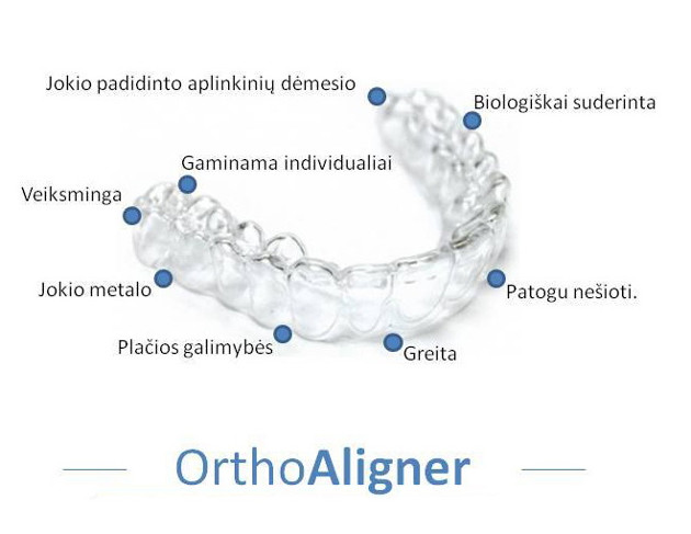 Dantų tiesinimui – skaidrios kapos OrthoAligner