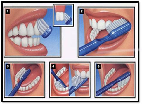 Profesionali burnos higiena: kodėl ji reikalinga?
