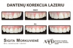 PRODENTAS, UAB - estetinės odontologijos klinika: visos odontologų paslaugos, dantų gydymas, tiesinimas, estetinis plombavimas