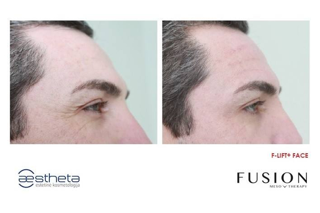 Estetinės kosmetologijos ir dermatologijos centras AESTHETA, UAB -  veido ir kūno procedūros, profesionalios ir dermatologinės kosmetikos pardavimas