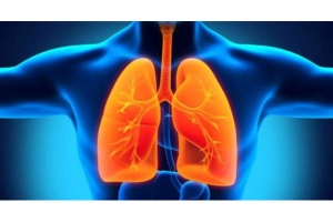 Tuberkuliozė – pagrindiniai faktai apie šią ligą