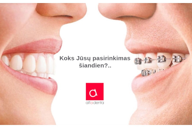  Dantų tiesinimas skaidriomis kapomis AirNivol – Alfadenta šiuolaikiniai estetinės odontologijos sprendimai
